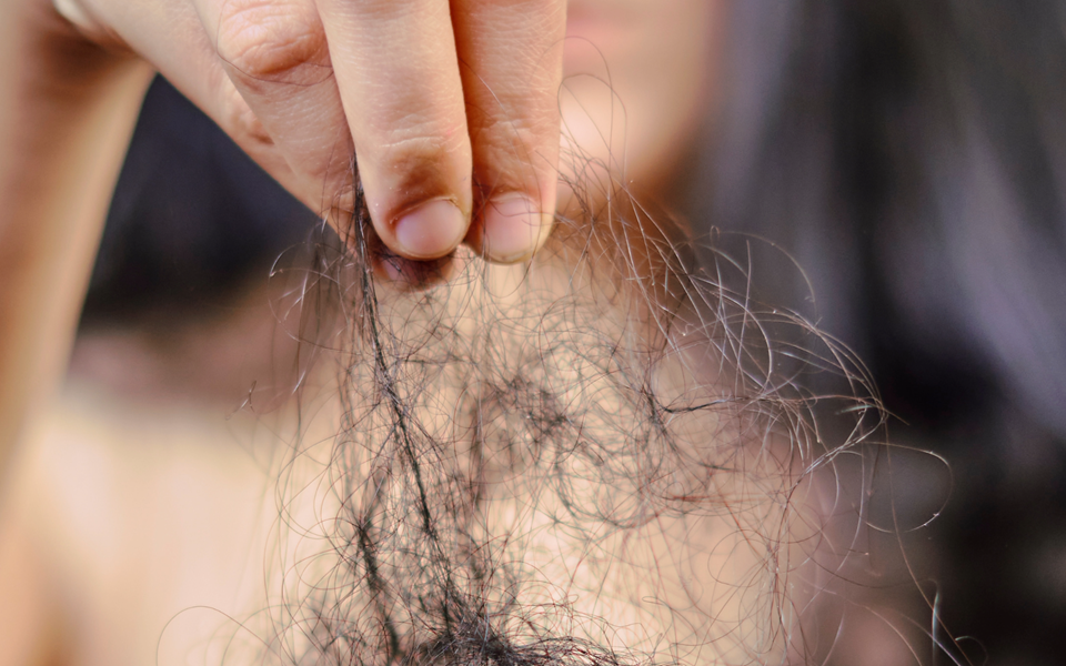 Hårtap Vid Ung Ålder